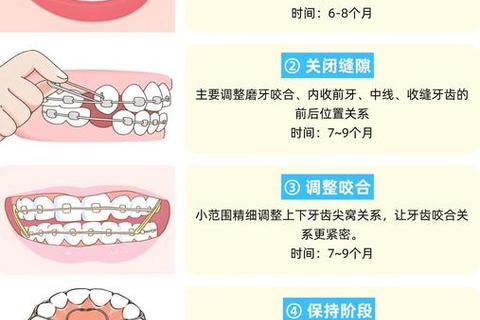 牙齿矫正是否影响运势?解析整牙与命运关联的真相 牙齿矫正是否影响运势?解析整牙与命运关联的真相