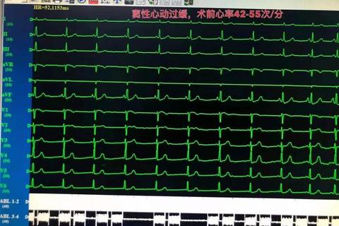 重医349真题解析:核心考点聚焦与高效复习路径剖析 重医349真题解析:核心考点聚焦与高效复习路径剖析