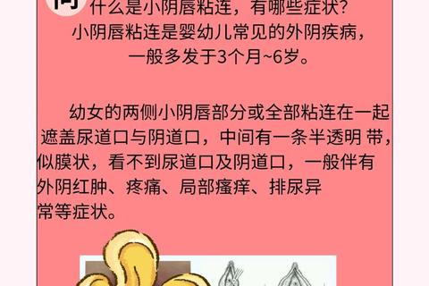 幼童妇科病解析：小女孩为何也会面临健康隐患