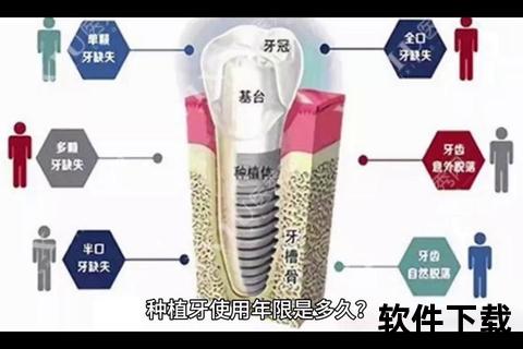 种植牙使用寿命解析-影响因素及科学维护延长年限指南
