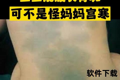 新生儿屁股乌青之谜：蒙古斑的医学解析与消退过程