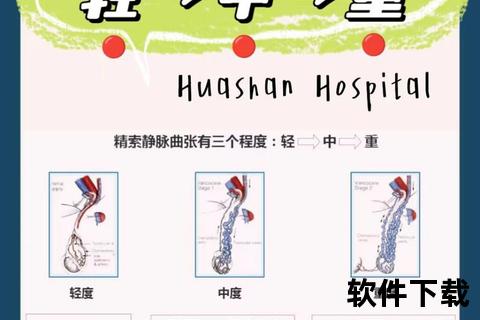 精索静脉曲张治疗指南：手术与药物综合方案解析