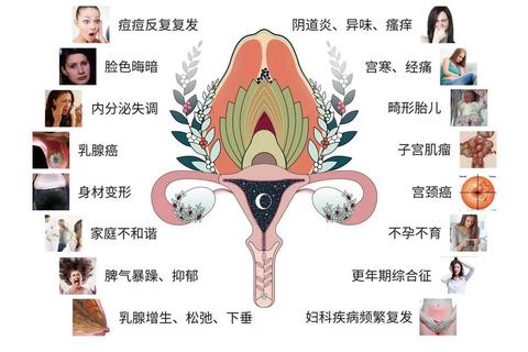 妇科健康新守护：草本科技重塑私密平衡