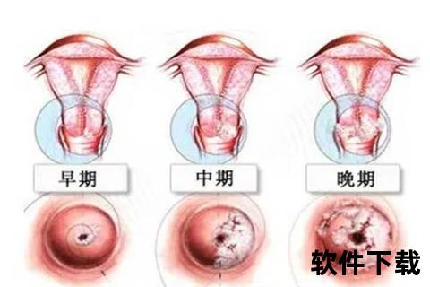 重度宫颈糜烂常见症状解析：异常出血与分泌物异常表现