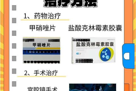 妇科最佳消炎药推荐指南-安全高效治疗炎症优选方案