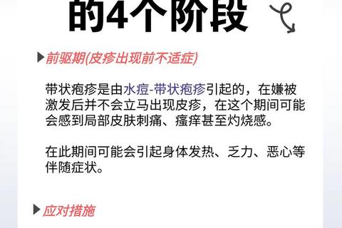 带状疱疹抗病毒治疗指南:一线用药选择与疗程规范解析