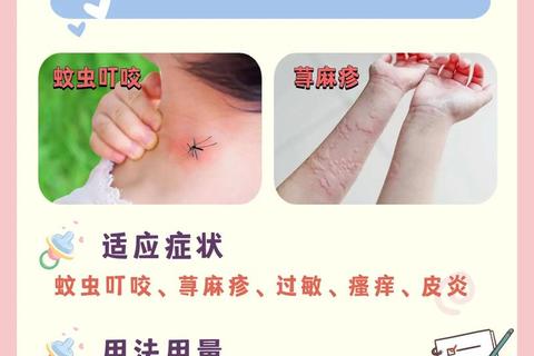 皮肤科外用药临床使用指南-适应症解析与操作规范