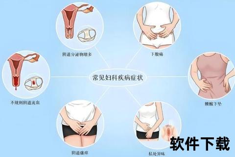 盆腔炎症状全解析：下腹痛、白带异常等六大表现