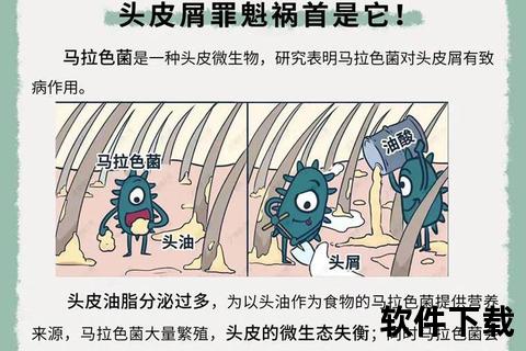 头皮屑暴增的深层诱因：马拉色菌感染与护理误区