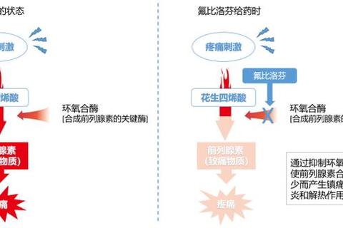 复方苯佐卡因凝胶_局部镇痛机制与临床适应症研究分析