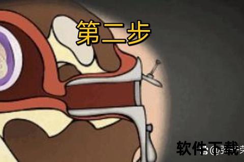 怀孕如何流产：安全方法_注意事项及流程步骤解析