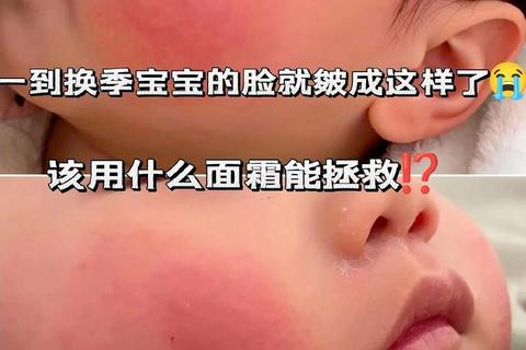 新生儿脸红红原因解析-生理现象及护理方法详解