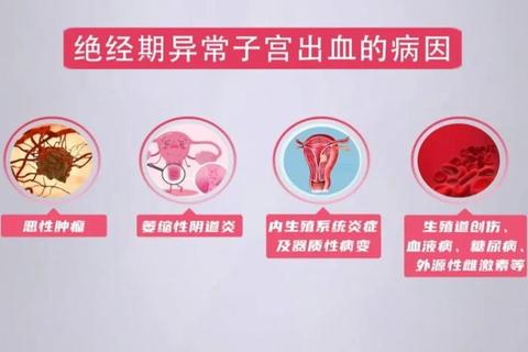 绝经后出血：常见原因与健康风险解析