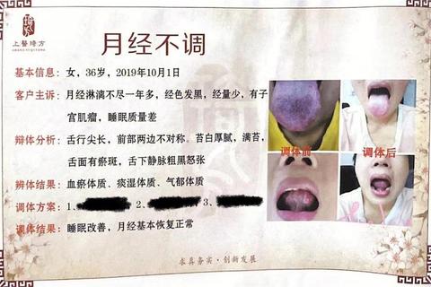 妇科疾病中医调治策略：体质辨识与经方疗法结合路径