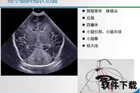 新生儿头颅出血_病因解析与防治策略研究