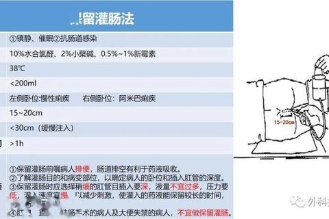 灌肠用药操作规范与安全指引-临床实践关键要点解析