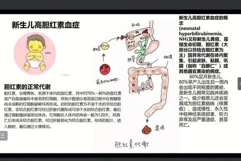 新生儿经皮胆红素检测技术_操作规范与临床价值探讨