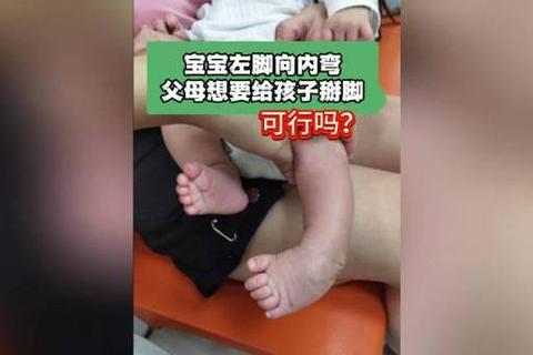 新生儿脚内翻矫正方法_科学治疗与家庭护理全攻略