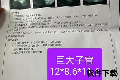 子宫肌瘤诊断方法解析：超声检查与MRI应用指南