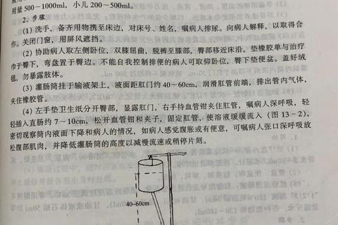 妇科灌肠的作用解析-治疗炎症与促进恢复的关键步骤