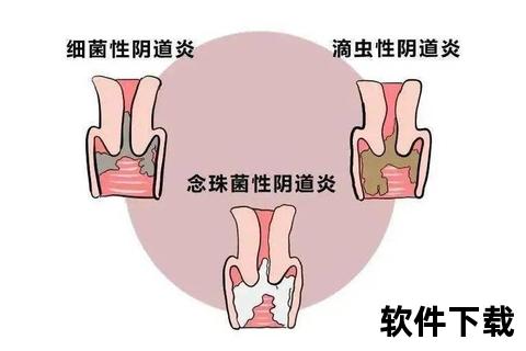 外阴瘙痒快速止痒指南:有效缓解方法与日常护理要点 外阴瘙痒快速止痒指南:有效缓解方法与日常护理要点