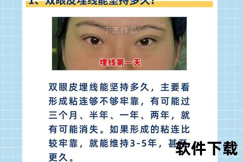 双眼皮埋线价格解析-手术费用及影响因素全介绍