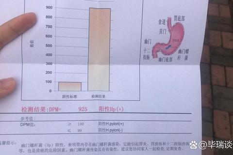 幽门螺杆菌根除治疗-一线用药方案及耐药应对策略