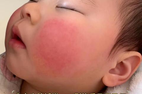 新生儿皮肤退红时间解析：多久恢复正常肤色？