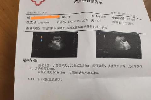月经不调挂号科室指南-医院就诊科别选择与解析