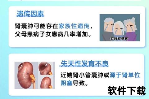 囊肿成因探源：遗传_炎症与激素失衡的相互作用