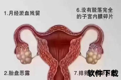 盆腔炎常见症状解析：下腹痛_白带异常_月经失调