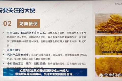 新生儿大便有奶瓣-原因解析与科学应对指南