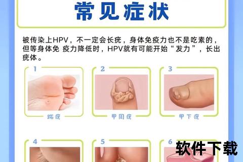HPV感染妇科症状自测指南_典型表现与识别图解 HPV感染妇科症状自测指南_典型表现与识别图解