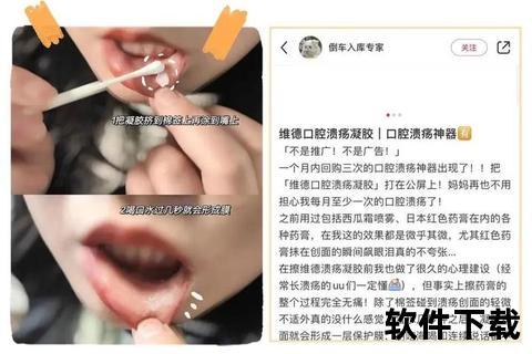 冰硼散妇科应用指南_炎症外治与操作技巧