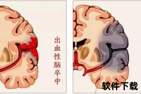 新生儿头颅出血_病因解析与防治策略研究