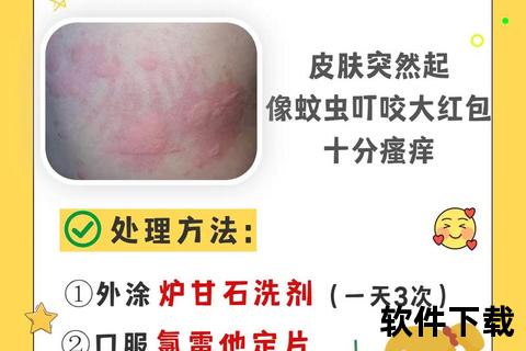 荨麻疹药物治疗指南-常用药物解析与安全使用建议