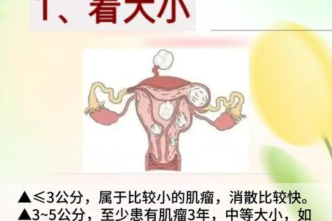 肌瘤会引起月经不调吗？解析症状关联与健康影响