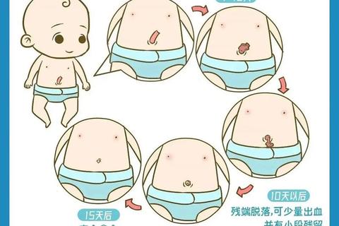 新生儿肚脐护理指南-正确消毒步骤与日常防护要点