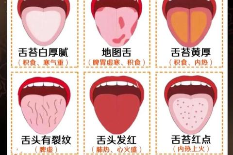 新生儿吐舌头现象解析_原因探究与正确应对方法