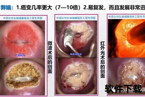 重度宫颈糜烂常见症状解析：异常出血与分泌物异常表现