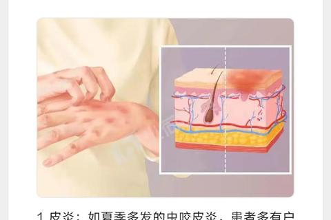 小孩皮肤红疙瘩瘙痒难耐-家庭护理与快速止痒方法指南