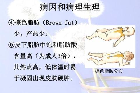 新生儿寒冷损伤综合征_危险因素与体温管理策略研究