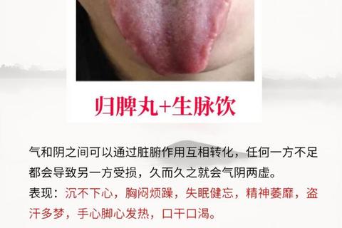 归脾丸功效作用详解-适用人群及使用注意事项