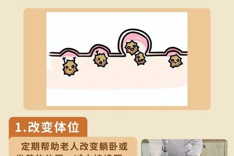 褥疮药物治疗方案-科学用药与护理要点全解析
