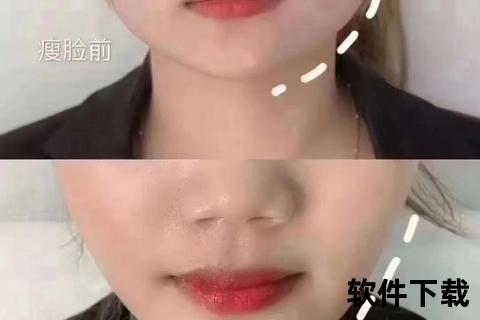 瘦脸针注射后多久见效_效果显现时间及注意事项解析
