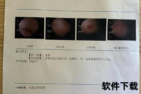 宫腔镜术前检查项目清单-关键步骤与注意事项解析 宫腔镜术前检查项目清单-关键步骤与注意事项解析