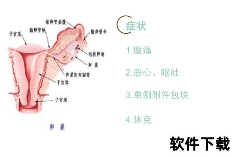 黄体破裂解析：育龄女性突发腹痛的常见原因