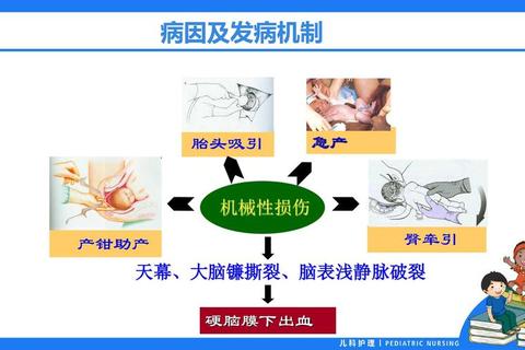 产钳助产新生儿危害解析:皮肤损伤_神经损伤与颅内出血 产钳助产新生儿危害解析:皮肤损伤_神经损伤与颅内出血