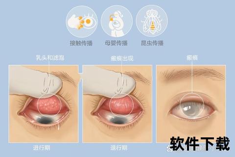 妇科沙眼衣原体感染症状解析-女性健康筛查与防治要点