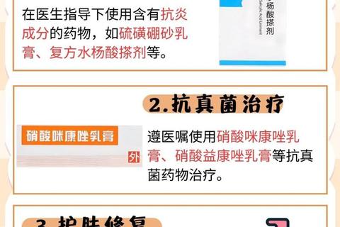 脂溢性皮炎用药指南：科学选药与安全治疗要点解析